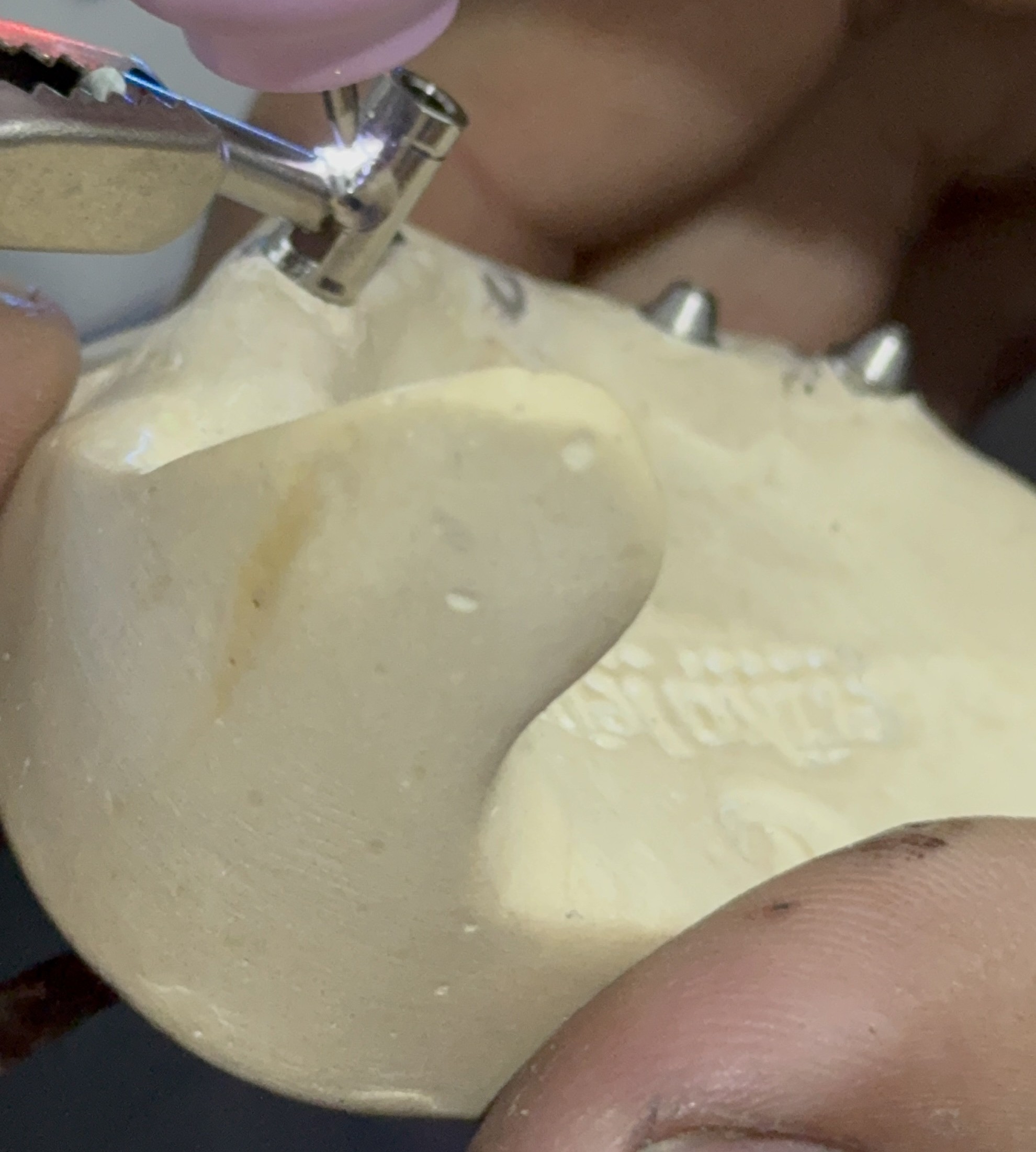 Solda para Ortodontia